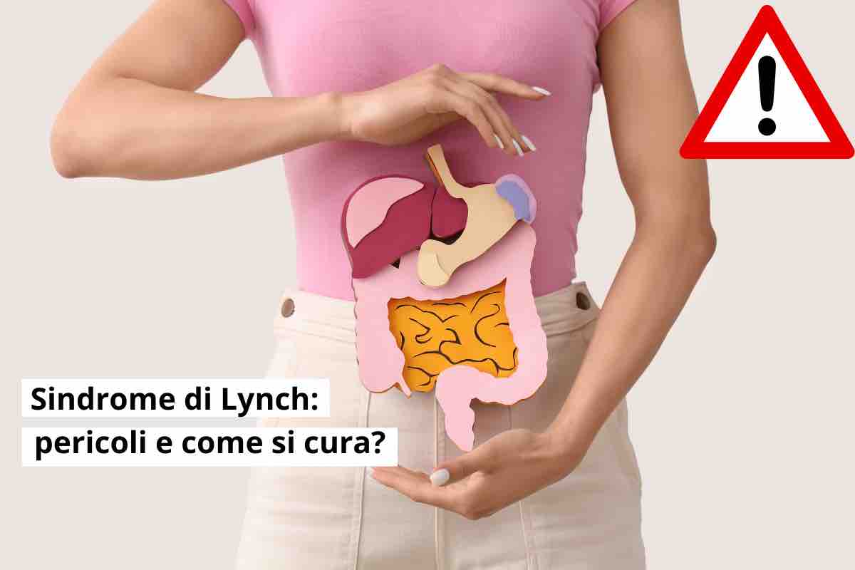 Sindorme di Lynch